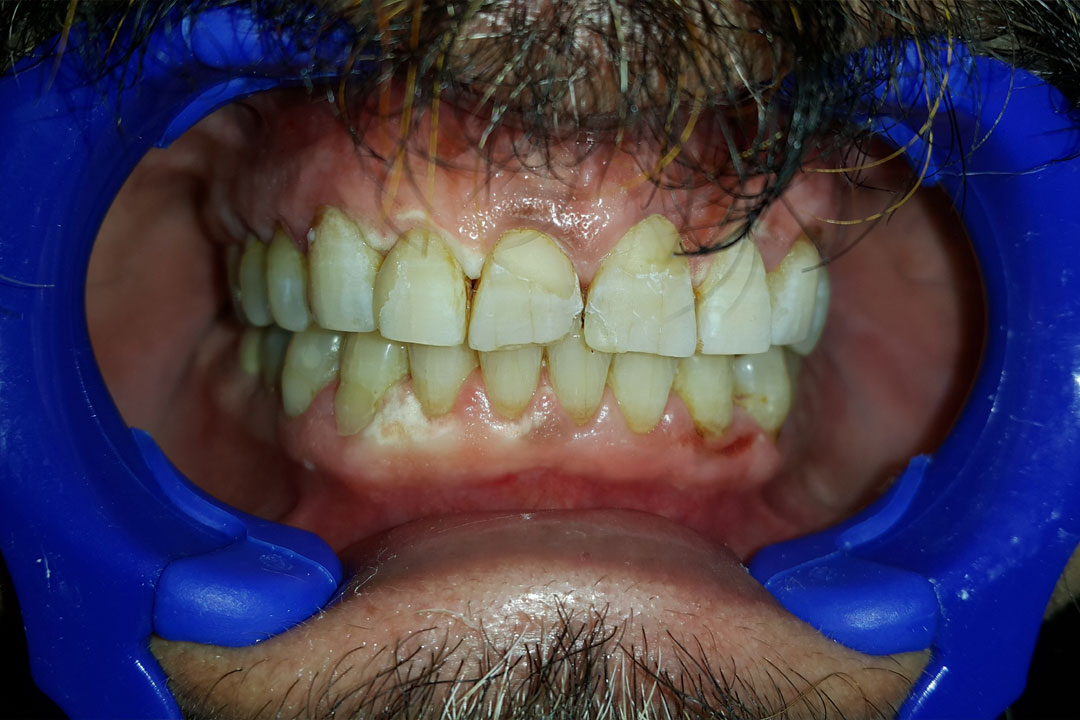 Wonders dentistry - مركز وندرز لعلاج الاسنان