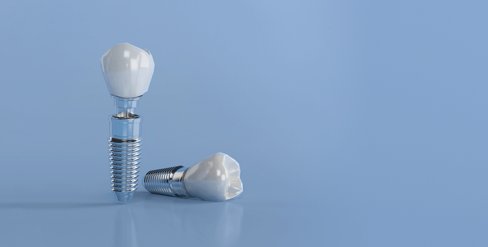 انواع تركيبات الأسنان - مركز وندرز لعلاج الاسنان - انواع تركيبات الاسنان - Types of dental prosthetics