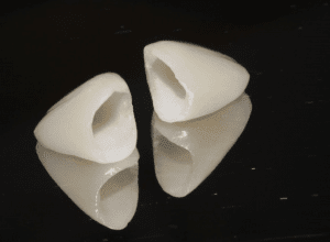 انواع تركيبات الأسنان - Types of dental prosthetics