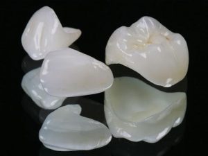 انواع تركيبات الأسنان - Types of dental prosthetics