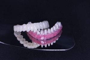 مقالات المدونة - Types of dental prosthetics