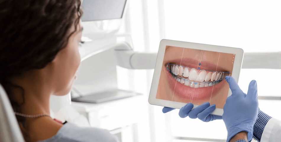 هوليود سمايل - مركز وندرز لعلاج الاسنان - ابتسامة هوليود - hollywood smile
