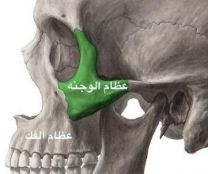زراعة الزيجوما - مركز وندرز لعلاج الاسنان