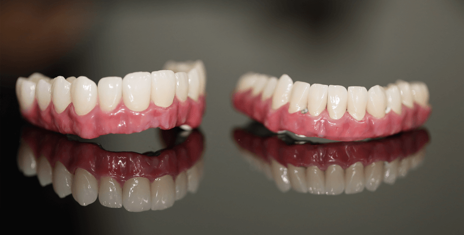 طقم الأسنان المتحرك - مركز وندرز لعلاج الاسنان - Removable Denture