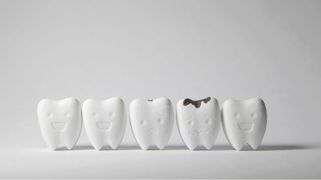 تعفن الأسنان - مركز وندرز لعلاج الاسنان - تعفن الاسنان - tooth rot