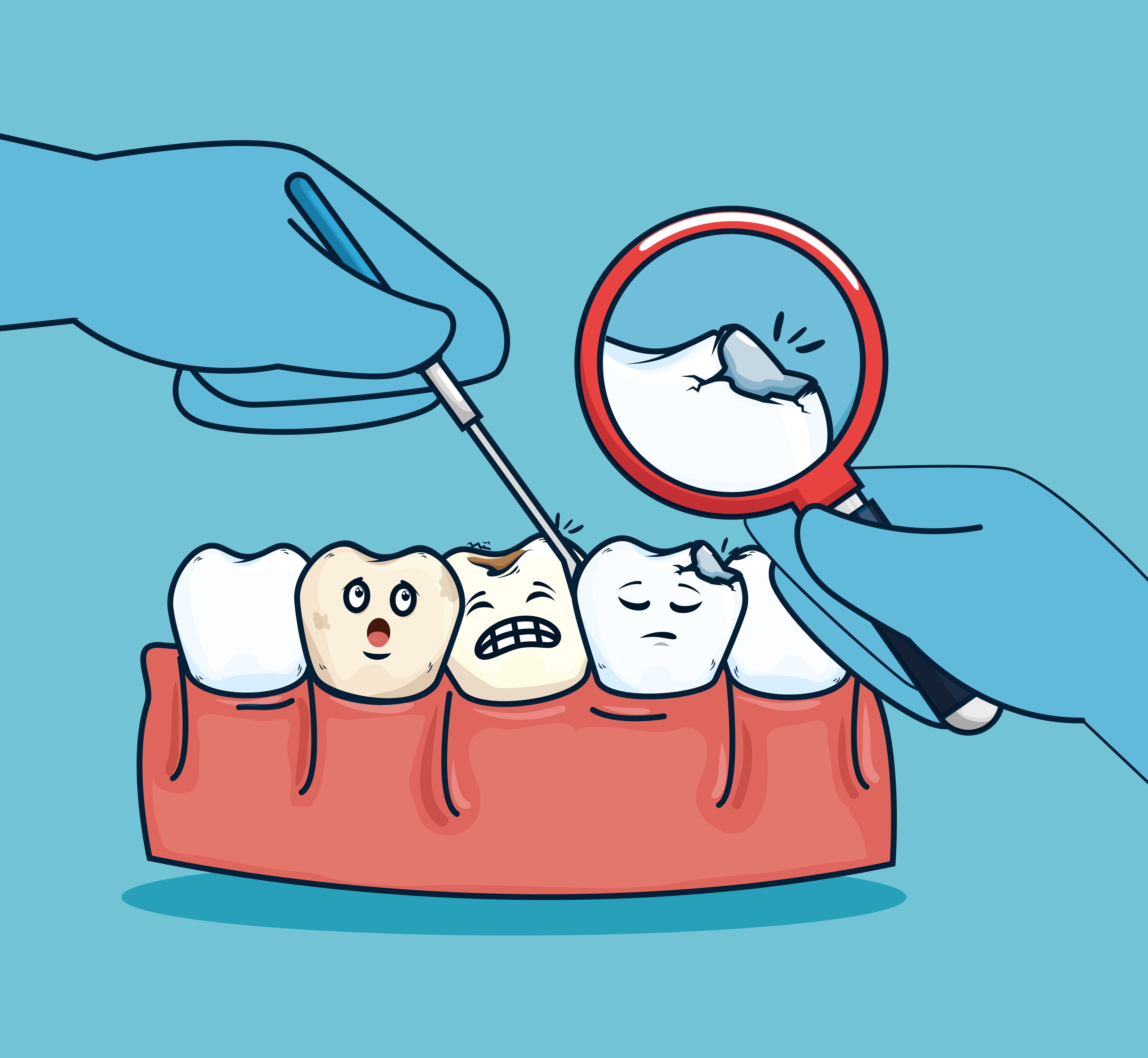 تزاحم الأسنان - tooth crowding