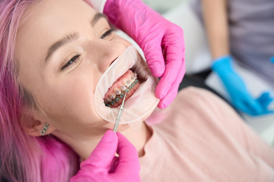 تقويم الاسنان للمصابين هشاشة العظام - orthodontics for patients with osteoporosis