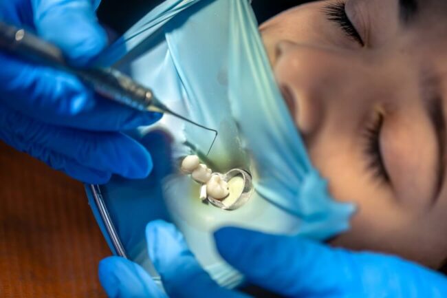 فشل تركيبات الأسنان - Dental Restoration Failure